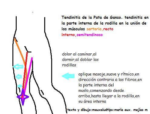 dolor en la parte superior externa del muslo al dormir